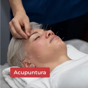 Acupuntura